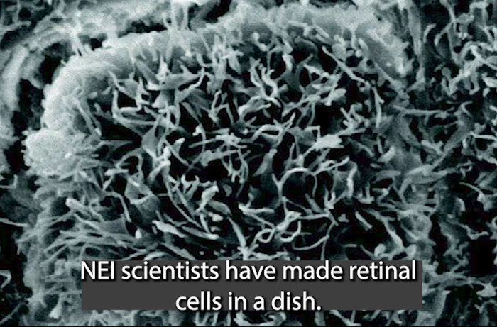 NEI scientists screen drugs with new stem-cell model of AMD
