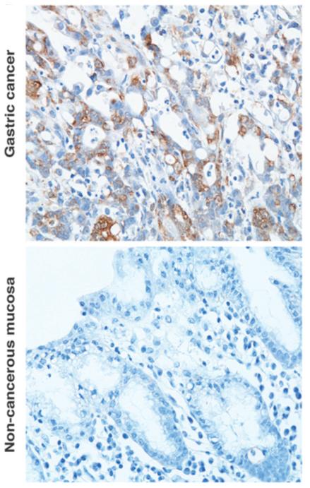 Microscopic Views of Human Stomach (Gastric) Cells