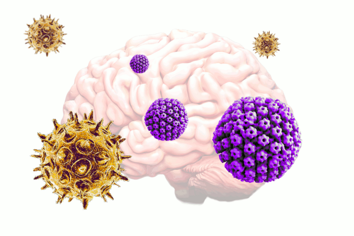 Varicella zoster virus, herpes simplex virus and Alzheimer's disease