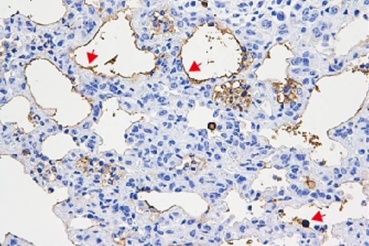 Corisin in lung tissue