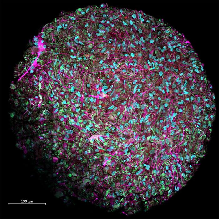 Close up of a brain organoid