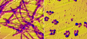 Images of the alpha-synuclein
