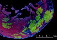 Stem Cells Integrating into Scarred Heart