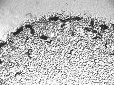 Nematode Aggregation