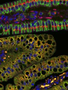 Mitochondrial dysfunction causes an extensive disorganization of the Golgi apparatus leading to impaired trafficking and accumulation of dietary lipids within lipid droplets in enterocytes.