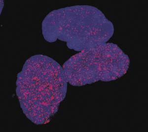 Persister cancer cells