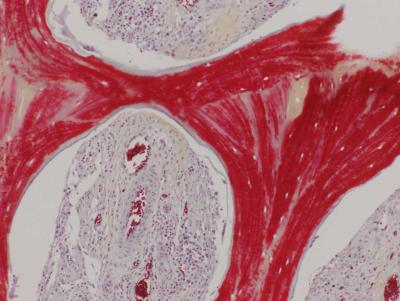 Regenerated Bone, with Mineralized Matrix (Red) and Strong Vascular Supply (Vessels with Red Blood C