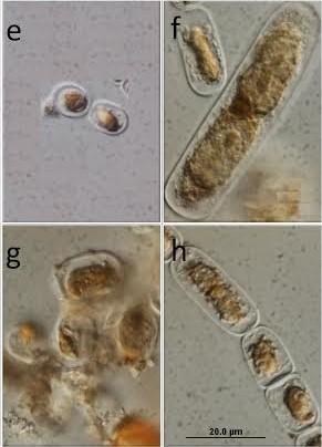 Ice algae Microscopic