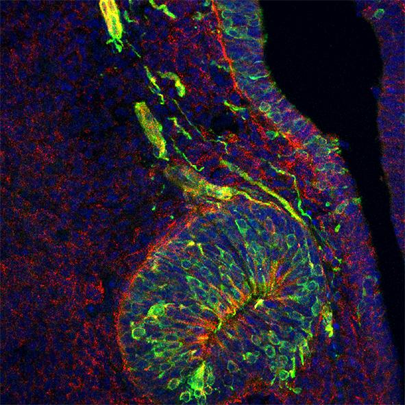 Puberty-Inducing Nerve Cells