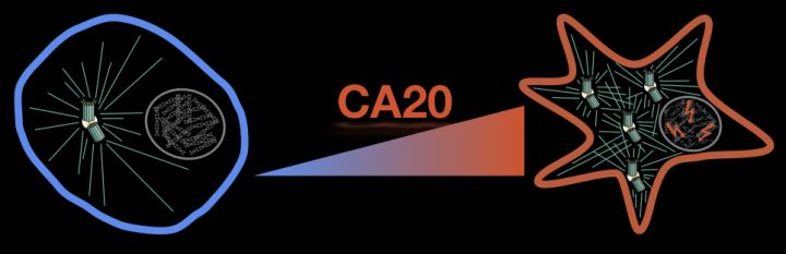 Centrosome Amplification in Cancer Prognosis