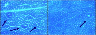 Control Diet and Cocoa Diet