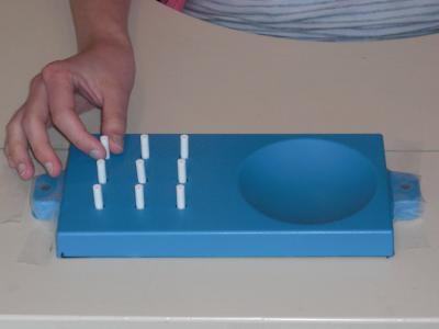 Hand Use Improved After Spinal Cord Injury (1 of 2)