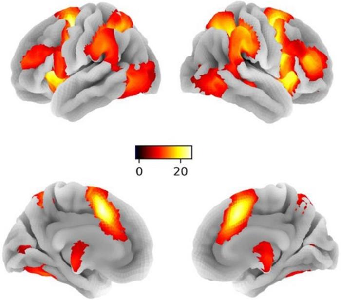 Brain activation maps for general response inhibition on whole brain level.