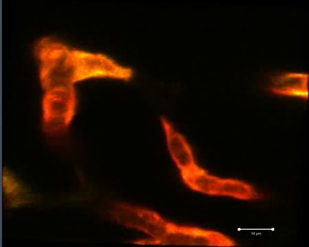 Macrophage Repair