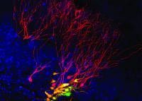 Stem Cells Evolving into Nerve Cells