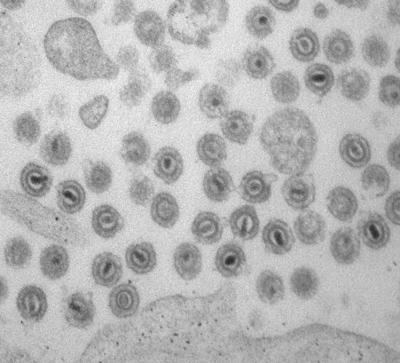 Cytomegalovirus Particles