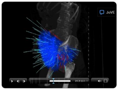 Imaging for Stereotactic Body Radiotherapy in Gynecologic Cancer (1 of 2)