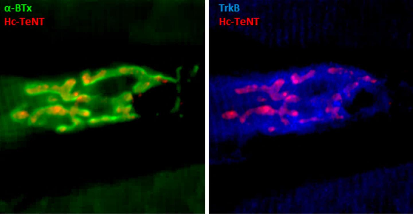 Mice neuromuscular junction in a tibialis anterior muscle slice