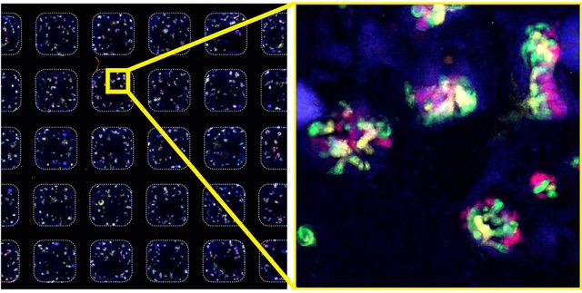 Microwell Plate of Kidney Organoids