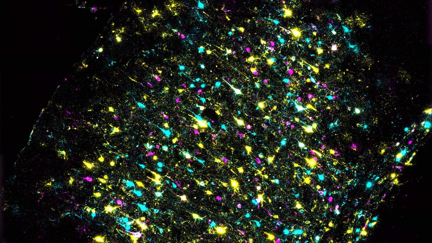 Neurons and Their Connections in a Mouse Brain