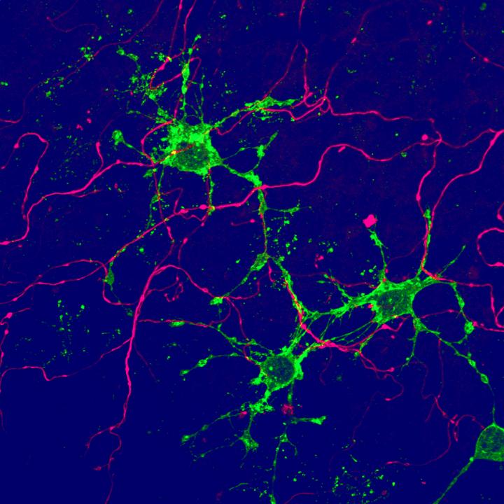 Identification of a Novel Glial Progenitor Cell