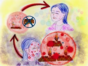 Clinical treatment against sarcoidosis