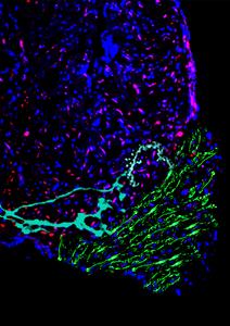 Section of a cryo-injured zebrafish heart