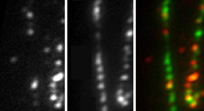 BBSome Complex Removes Signaling Proteins from Flagella