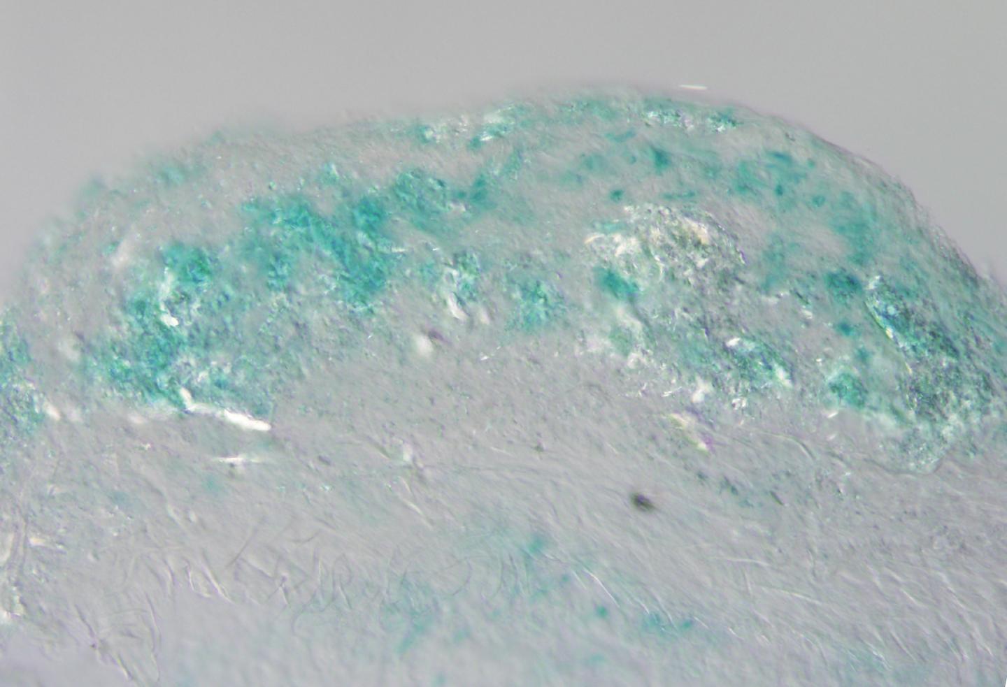 A Culprit Cell that Drives Plaque Buildup in Arteries