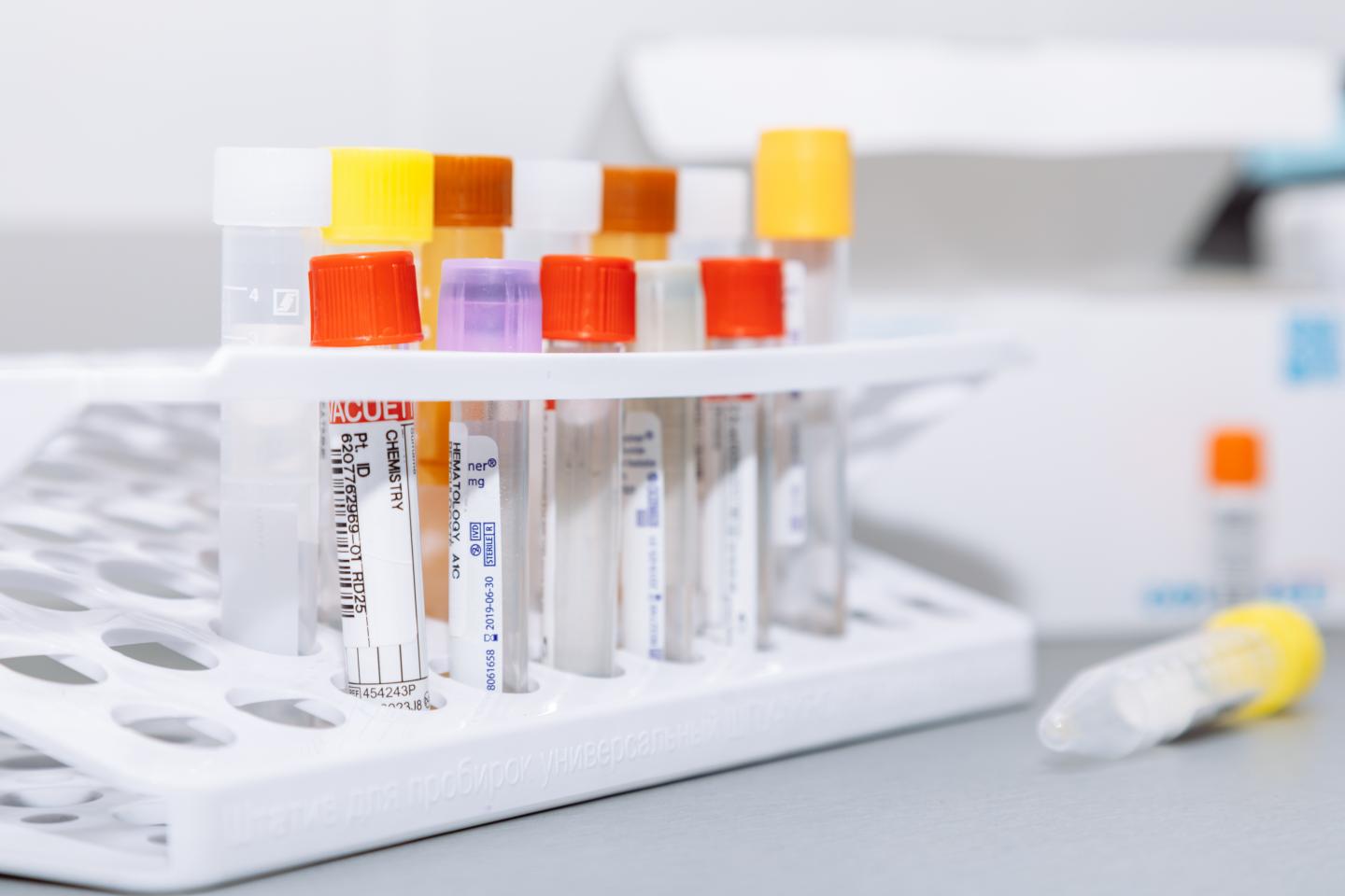 Capsule Composition for an Enzyme