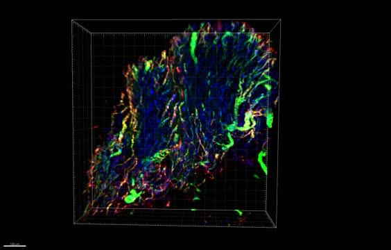 3D Light Sheet Microscopy