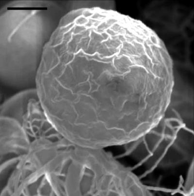 SEM of <I>Rhizidium phycophilum</I>