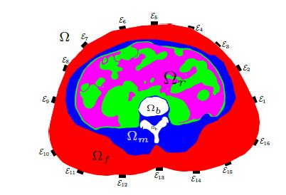 Simplified Abdomen Image from CT with Electrodes