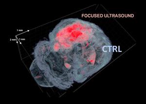 Mouse brain 3D fluorescence imaging with CLARITY showcasing the BBB opened volume for gene delivery.