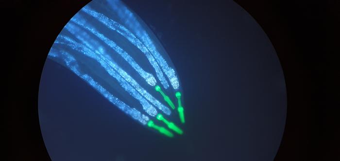 Bar-Ilan University researchers develop innovative platform for modeling human muscle diseases in worms