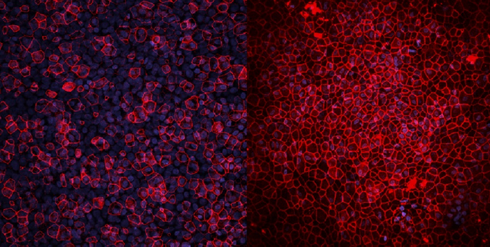 Model lung organoid under the microscope