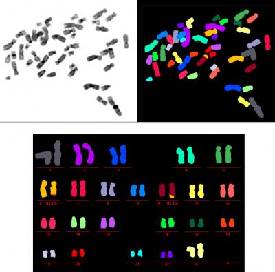 FISH-ing for Links Between Cancer and Aging