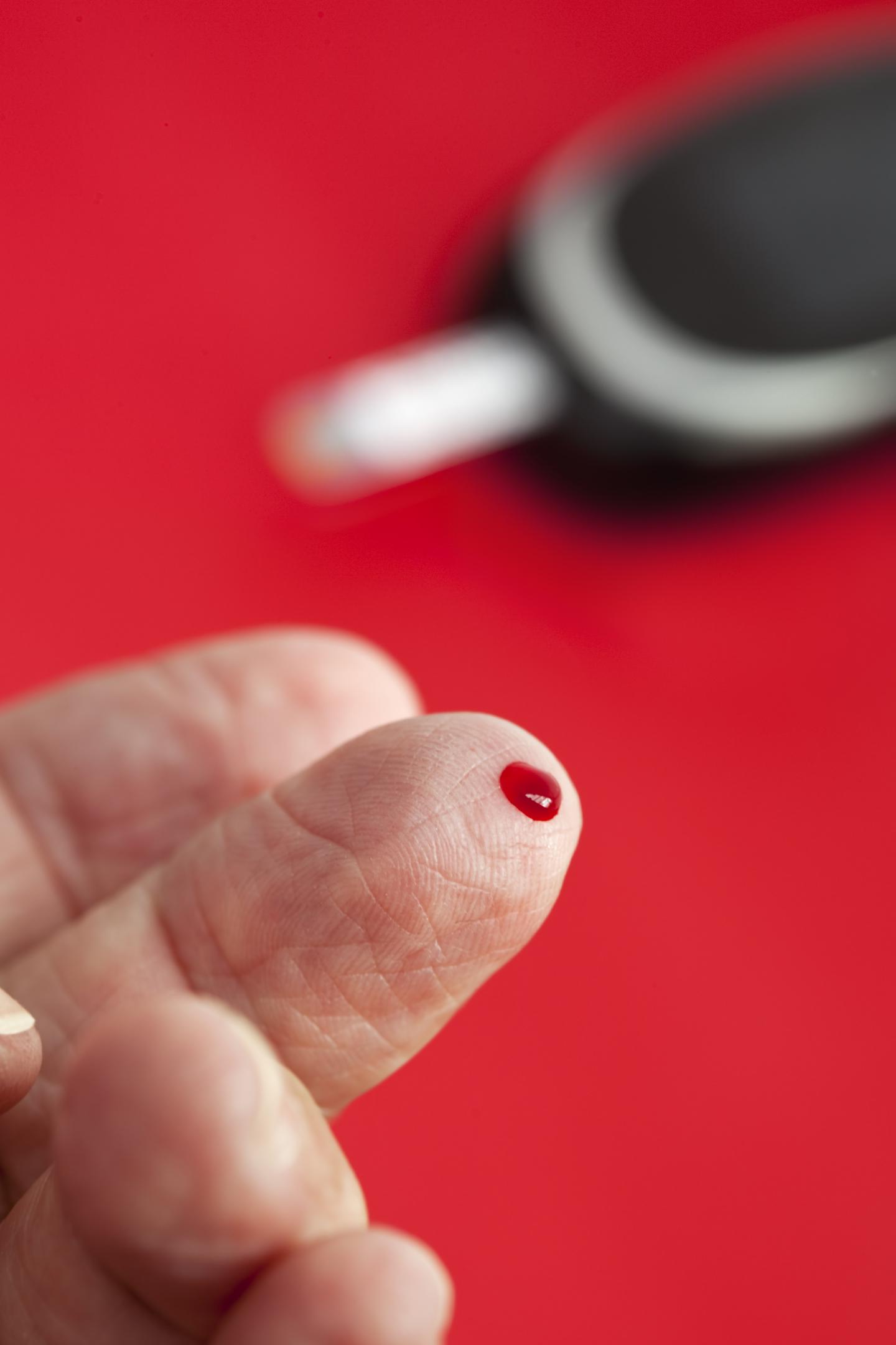 Diabetes in Patients with Sleep Apnea