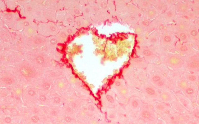 Sirius Red Casp2, UC San Diego Health