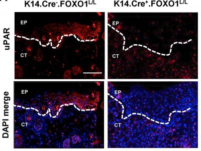 Migrating Skin Cells