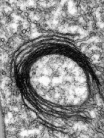 Impaired Mitochondrion