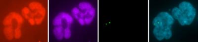 Tracking Chromosome Missegregation