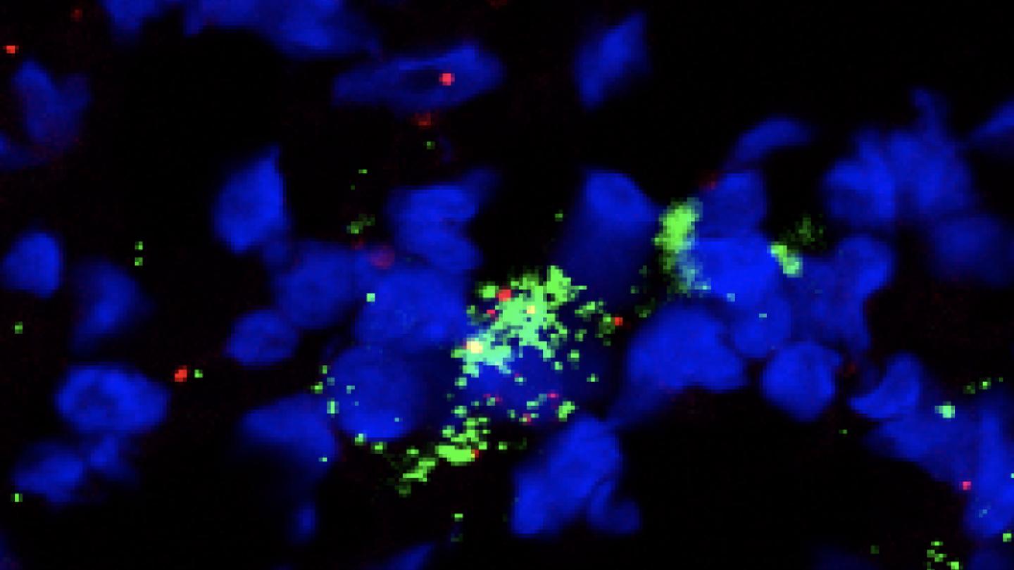 Fibroblastic reticular cell