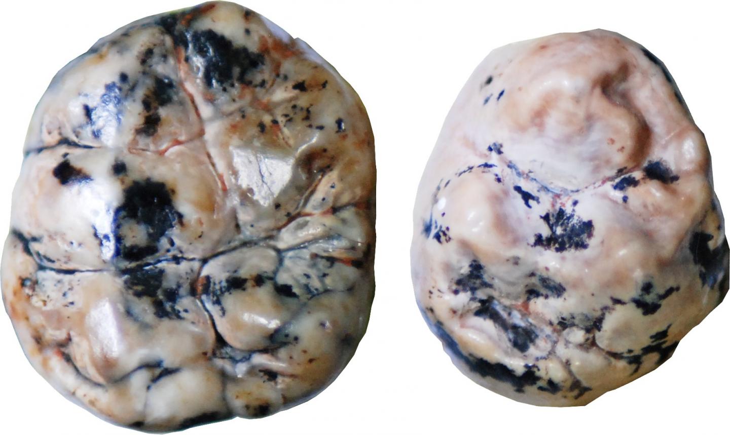 Differences in Dental Morphology