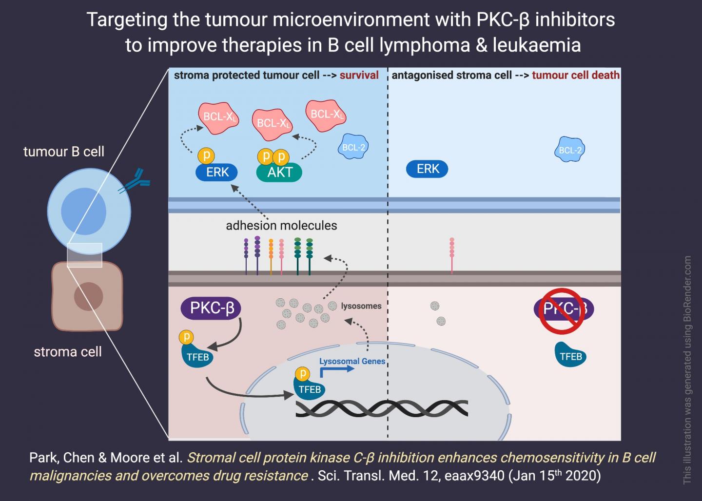 Strangling the Stroma Overcomes Treatment Resistance in B Cell Cancers (2 of 3)