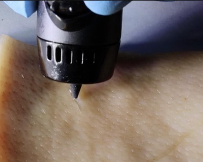 PAINTing a wound-healing ink into cuts with a 3D-printing pen