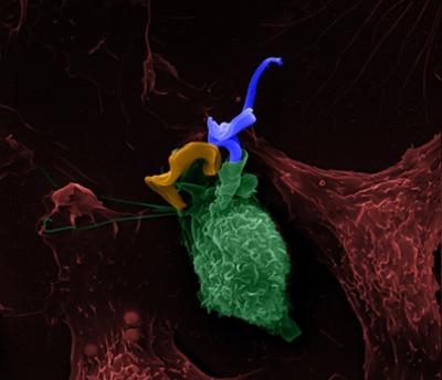 Trypanosome Parasite