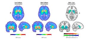 Caffeine impact