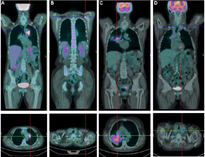 Representative Examples of Two Patients Enrolled in Present Study