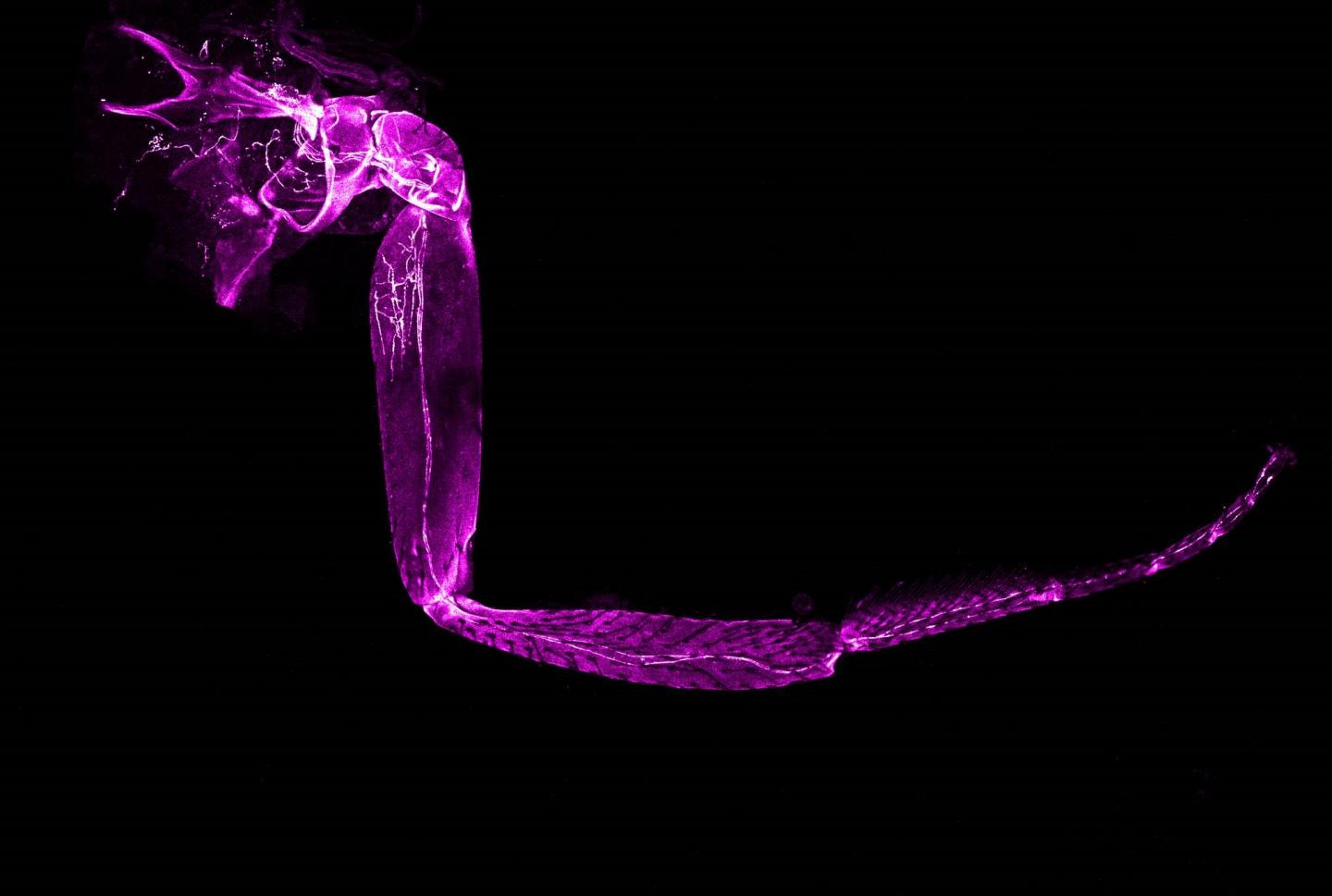 Side View of One of the Drosophila (Fruit Fly) Legs Mrsa